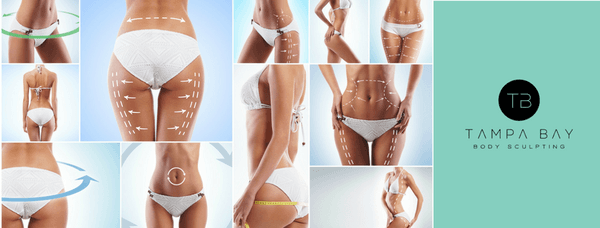 Common areas for liposuction