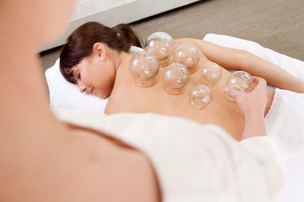 Cupping specials $30