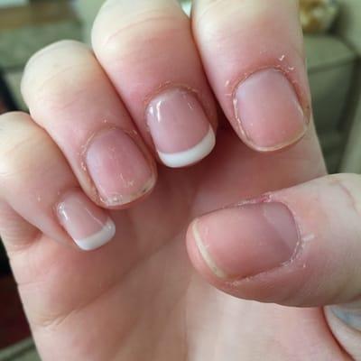 4 days after gel manicure. Also really tore up my skin around nail :-(