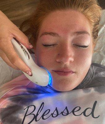 blue light LED therapy-- helps fight the bacteria that creates acne!