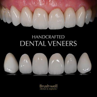 Brushwell Dental and Implants