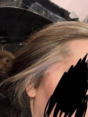 White/purple fried hair on my temple and a chemical burn from the products she used with poor application.