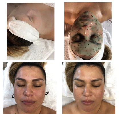 Clarifying Facial