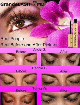 We sell Grande Lash MD!!!