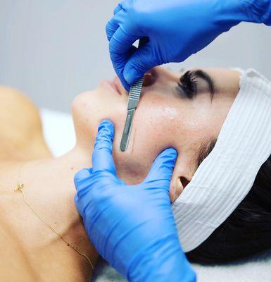 Dermaplaning