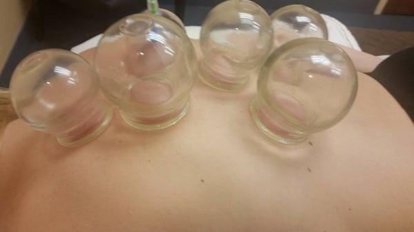 Call to schedule an appointment for cupping!