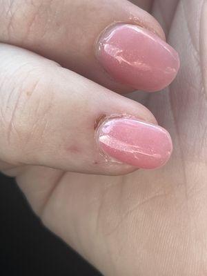 You can see where my cuticle was scraped, multiple times, my the rotating sander tool