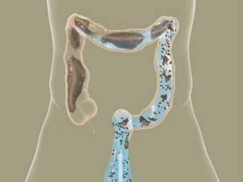 How the process works, breaking up fecal matter for release