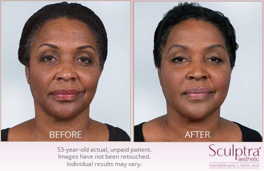 Crescent Cosmetic Surgery