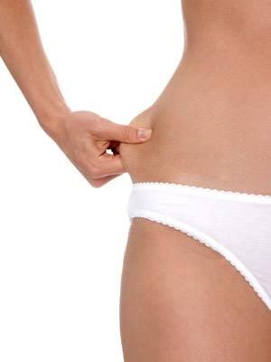 Liposuction in Naples, FL