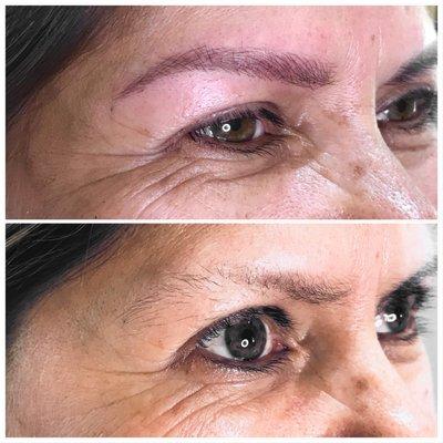 Microblading