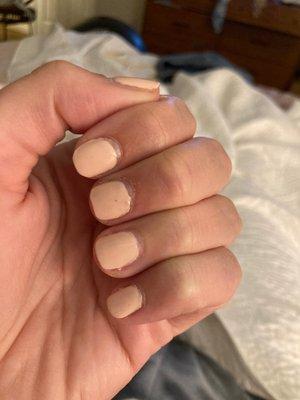 One week post gel manicure