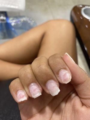 Natural nails after they ripped off the tips instead of properly soaking them.