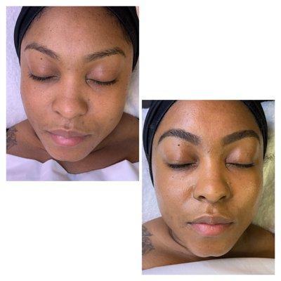 Facial, dermaplane and brow tint