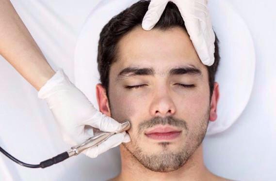 Gentleman's Microdermabrasion