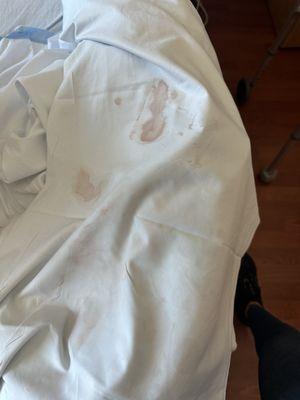 Sheets with blood for hours, not changed until daughter patient came and complained