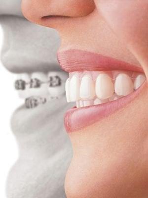 Specializing in Orthodontics and TMJ Therapy