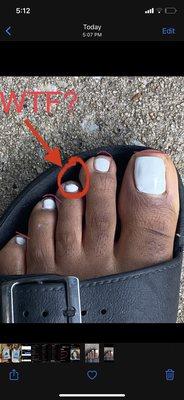 Wtf? Basic Pedicure #Fail