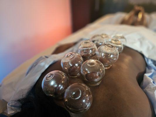 Cupping therapy can be helpful for back pain.