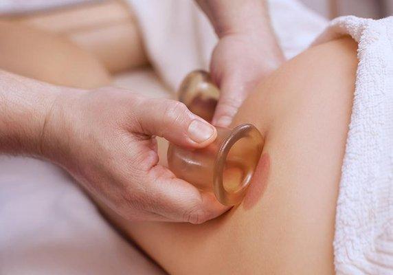 Carolyn Boyd offers cupping as an add on to Swedish or Deep Tissue massages.