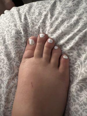 Toe nails