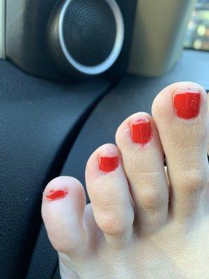 Terrible pedicure