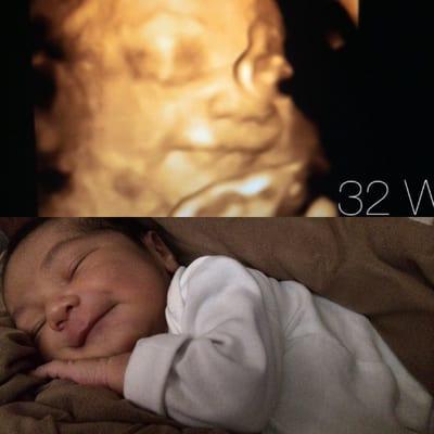 32 week ultrasound and 1 week old- almost identical