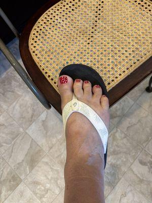 They fixed my ingrown toe nail and made my toes look festive.