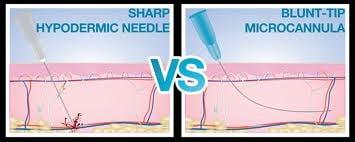 Cannula technique and Needle technique for doing dermal fillers such as Juvederm.