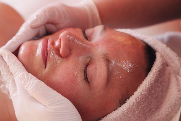 Post-Dermaplane Facial