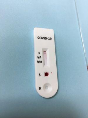 Covid 19 times requirement before being serviced. Quick antibody test. Yay for negative.