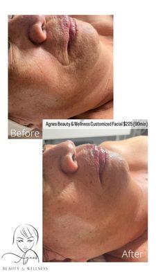 Customized Facial Huntington Beach