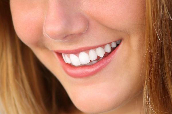 teeth whitening