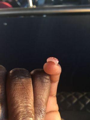 My pinky was also thicker than the other nails