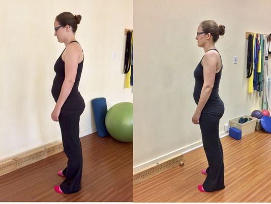 Here's a before and after picture of one of my clients' posture. This was after just one session! I love Pilates.