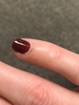 The scab from where my manicurist made me bleed while cutting my cuticles. It's 3 days later and it still hurts!