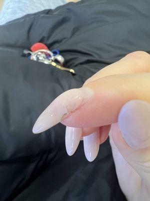 Cracked hard gel