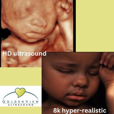 HD to 8K ultrasound edits offered at Goldenview Ultrasound San Antonio.