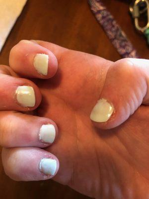 Blotchy gel "manicure". (Hand 2)