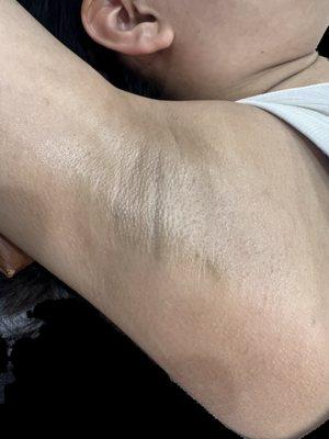 underarm wax