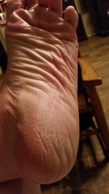 This is my feet after leaving Tracy's with my 30.00 pedicure today. The worst pedi I've ever had.