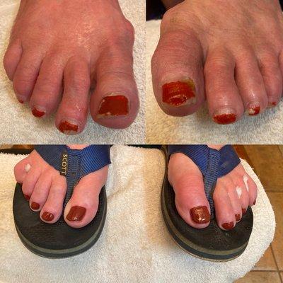 Pedicure  treatment by Kathy