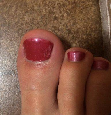 Cut beneath my big toe and then a blob of paint added to the side where he missed a spot. (No - it wasn't from a smudge)