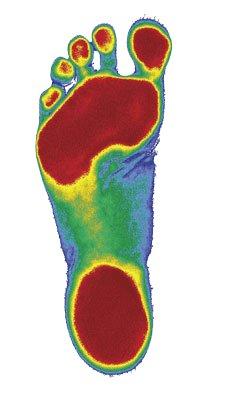 The foundation of the body is the Foot. We provide digitized impressions of the foot to see if custom orthotics can help you.