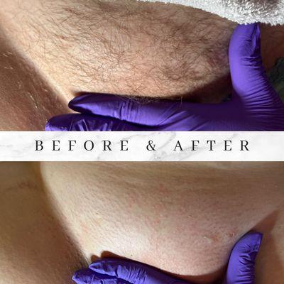 Waxing before and after