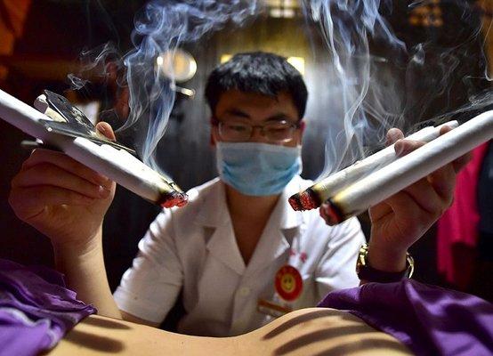 Moxibustion