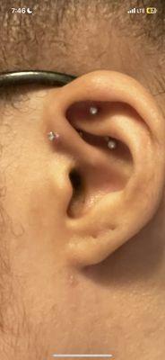 Forward helix at an incorrect angle