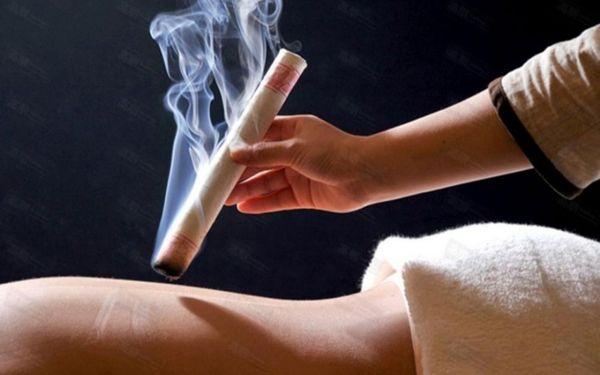 Moxibustion