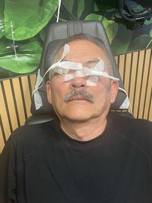 Me undergoing the LipiFlow Thermal Pulsation Treatment. This treatment was a game changer.