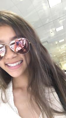 My babygirl wears clear braces (upper teeth) thanks Dr. Pascual (he's an awesome orthodontist)